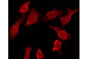 Immunofluorescence (fixed cells) (IF/ICC) image for anti-P-Cadherin (CDH3) (N-Term) antibody (ABIN6258296)