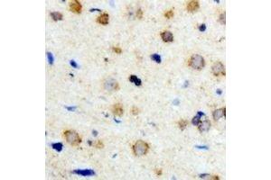 Immunohistochemical analysis of ICK staining in human brain formalin fixed paraffin embedded tissue section. (ICK antibody)