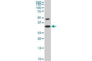 HOXD8 monoclonal antibody (M03), clone 5E11 Western Blot analysis of HOXD8 expression in HepG2 .