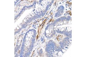 Immunohistochemistry (IHC) image for anti-Melanoma Cell Adhesion Molecule (MCAM) (AA 447-646) antibody (ABIN6143621)