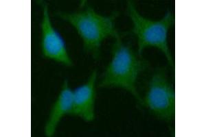 ICC/IF analysis of PPIC in HeLa cells line, stained with DAPI (Blue) for nucleus staining and monoclonal anti-human PPIC antibody (1:100) with goat anti-mouse IgG-Alexa fluor 488 conjugate (Green). (PPIC antibody  (AA 39-197))