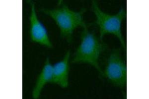 ICC/IF analysis of PPIC in HeLa cells line, stained with DAPI (Blue) for nucleus staining and monoclonal anti-human PPIC antibody (1:100) with goat anti-mouse IgG-Alexa fluor 488 conjugate (Green). (PPIC antibody)