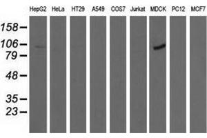 Western blot analysis of extracts (35 µg) from 9 different cell lines by using anti-ALDH1L1 monoclonal antibody. (ALDH1L1 antibody)