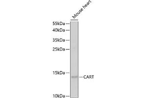 Western blot analysis of extracts of mouse heart, using CART antibody (ABIN6131305, ABIN6137949, ABIN6137950 and ABIN6221042) at 1:1000 dilution. (CARTPT antibody  (AA 28-116))