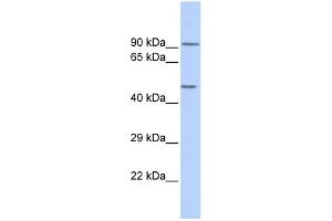 WB Suggested Anti-KCNJ8 Antibody Titration: 0. (KCNJ8 antibody  (Middle Region))