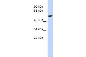 WB Suggested Anti-ZNF154 Antibody Titration:  0. (ZNF154 antibody  (N-Term))