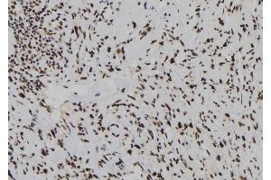 ABIN6278246 at 1/100 staining Human gastric tissue by IHC-P. (Dual Specificity Phosphatase 3 (DUSP3) (N-Term) antibody)