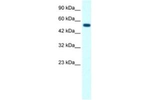 Western Blotting (WB) image for anti-Glycine Receptor, alpha 1 (GLRA1) antibody (ABIN2463727) (GLRA1 antibody)