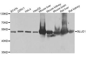 Western blot analysis of extracts of various cell lines, using GLUD1 antibody. (GLUD1 antibody  (AA 54-240))