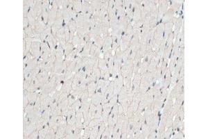 Immunohistochemistry of paraffin-embedded Rat heart using DMD Polyclonal Antibody at dilution of 1:100 (40x lens). (Dystrophin antibody)