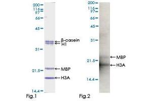 Kinase Activity Assay (KAA) image for Protein Kinase C, iota (PRKCI) (AA 1-587) protein (GST tag) (ABIN1316270)