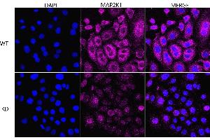 Immunocytochemical staining of HeLa cells using MAP2K1 antibody (ABIN7799460), 1:1,000), Top panel: wild-type (WT), Bottom panal: MAP2K1 shRNA knockdown (KD). (Recombinant MEK1 antibody)