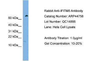 WB Suggested Anti-IFITM5  Antibody Titration: 0. (IFITM5 antibody  (Middle Region))