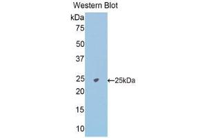 Western Blotting (WB) image for anti-N-Acetylgalactosaminidase, alpha (NAGA) (AA 18-217) antibody (ABIN1176641) (NAGA antibody  (AA 18-217))
