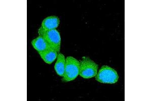 IF analysis of S100A4 using anti-S100A4 antibody (ABIN7600462). (s100a4 antibody  (AA 2-101))