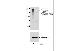 Western blot analysis of lysate from A431 cell line, using Phospho-HUN-PIK3C2B (ABIN6241073 and ABIN6578945). (PIK3C2B antibody  (pTyr228))