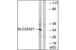 Western blot analysis of extracts from HepG2 cells, using SLC25A21 Antibody   The lane on the right is treated with the synthesized peptide. (SLC25A21 antibody  (Internal Region))