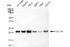 anti-Ubiquitin-Conjugating Enzyme E2M (ube2m) antibody