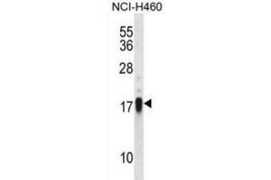 Western Blotting (WB) image for anti-CD70 Molecule (CD70) antibody (ABIN2998201) (CD70 antibody)