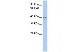 LIX1L antibody used at 1 ug/ml to detect target protein. (LIX1L antibody)