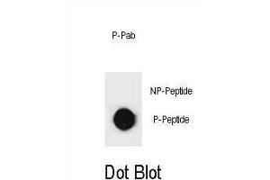 Dot blot analysis of KIT Antibody (Phospho ) Phospho-specific Pab (ABIN1881481 and ABIN2850471) on nitrocellulose membrane. (KIT antibody  (pSer891))