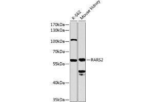 Western blot analysis of extracts of various cell lines, using R antibody (ABIN6129727, ABIN6146710, ABIN6146711 and ABIN6224588) at 1:1000 dilution. (RARS2 antibody  (AA 17-340))