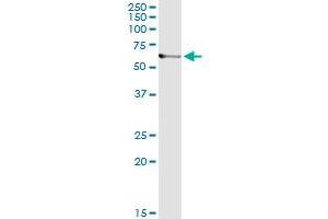 Immunoprecipitation of ARHGEF5 transfected lysate using anti-ARHGEF5 monoclonal antibody and Protein A Magnetic Bead , and immunoblotted with ARHGEF5 MaxPab rabbit polyclonal antibody. (ARHGEF5 antibody  (AA 1-519))