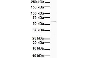 WB Suggested Anti-SLC7A1 antibody Titration: 1 ug/mL Sample Type: Human MDA-MB-435s (SLC7A1 antibody  (N-Term))