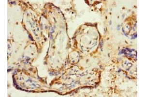 Immunohistochemistry of paraffin-embedded human placenta tissue using ABIN7176726 at dilution of 1:100 (ZP2 antibody  (AA 651-745))