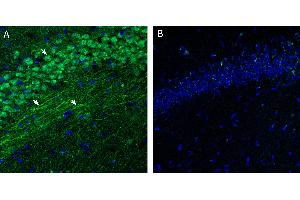 Free-floating frozen brain sections from a paraformaldehyde-perfused mouse were incubated with Anti-S1PR3 (EDG3) (extracellular) Antibody (ABIN7043774, 1:300), followed by goat anti-rabbit secondary antibody conjugated to Alexa Fluor® 488 (green).