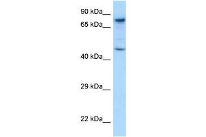 WB Suggested Anti-Skil Antibody Titration: 1. (SKIL antibody  (C-Term))