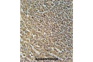 Immunohistochemistry (IHC) image for anti-RAS Protein Activator Like 3 (RASAL3) antibody (ABIN2995724) (RASAL3 antibody)