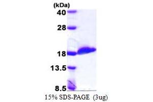 SDS-PAGE (SDS) image for Ubiquitin-Conjugating Enzyme E2D 2 (UBE2D2) (AA 1-147) protein (His tag) (ABIN667507)