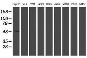 Image no. 2 for anti-Asparagine-Linked Glycosylation 2, alpha-1,3-Mannosyltransferase Homolog (ALG2) antibody (ABIN1496610) (ALG2 antibody)