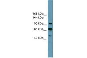 Image no. 1 for anti-Retinoblastoma Protein (Rb Protein) (C-Term) antibody (ABIN6744235) (Retinoblastoma Protein (Rb) antibody  (C-Term))