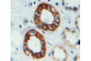 #VALUE! (Nephrin antibody  (AA 27-234))