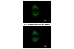 ICC/IF Image Immunofluorescence analysis of methanol-fixed A549, using GRAP, antibody at 1:500 dilution. (GRAP antibody  (C-Term))