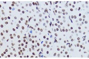 Immunohistochemistry (Paraffin-embedded Sections) (IHC (p)) image for anti-Histone H2B (acLys12) antibody (ABIN7258518)