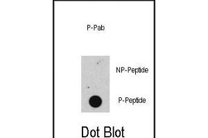 Dot blot analysis of anti-Phospho-RB- Antibody (ABIN389642 and ABIN2839634) on nitrocellulose membrane. (Retinoblastoma 1 antibody  (pSer608))