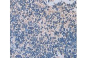 Figure. (IGFBP2 antibody  (AA 24-305))