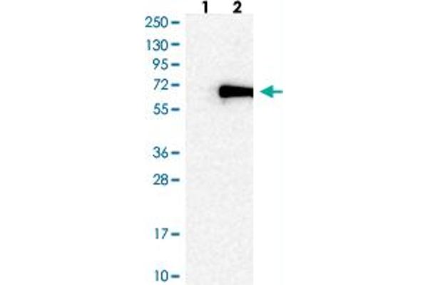 ZNF155 anticorps