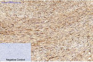 Immunohistochemical analysis of paraffin-embedded human uterus tissue. (MICU1 antibody)