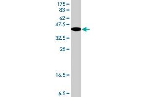 Western Blot detection against Immunogen (37. (CBS antibody  (AA 1-100))