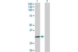 Western Blot analysis of NAT2 expression in transfected 293T cell line by NAT2 monoclonal antibody (M01), clone 3B5. (NAT2 antibody  (AA 96-195))