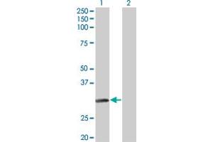Western Blot analysis of NAT2 expression in transfected 293T cell line by NAT2 monoclonal antibody (M01), clone 3B5.