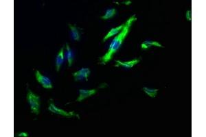 Immunofluorescence staining of U251 cells with ABIN7140173 at 1:200, counter-stained with DAPI. (TJP2 antibody  (AA 1165-1183))