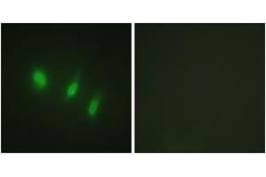 Immunofluorescence (IF) image for anti-Forkhead Box O4 (FOXO4) (AA 417-466) antibody (ABIN2888912) (FOXO4 antibody  (AA 417-466))