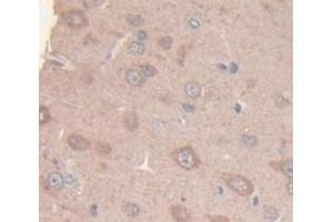 Figure. (KIF5A antibody  (AA 823-1027))