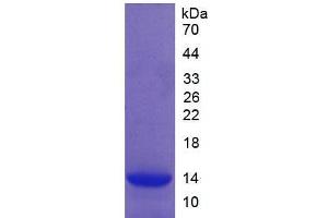 SDS-PAGE (SDS) image for Complement Factor B (CFB) (AA 32-157) protein (His tag) (ABIN1170193) (Complement Factor B Protein (CFB) (AA 32-157) (His tag))