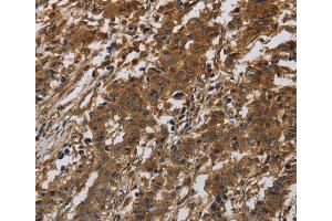 Immunohistochemistry (IHC) image for anti-Integrin beta 7 (ITGB7) antibody (ABIN2433217) (Integrin beta 7 antibody)